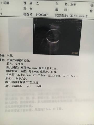 journal_insert_pic_583859427