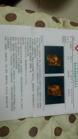 journal_insert_pic_585190686