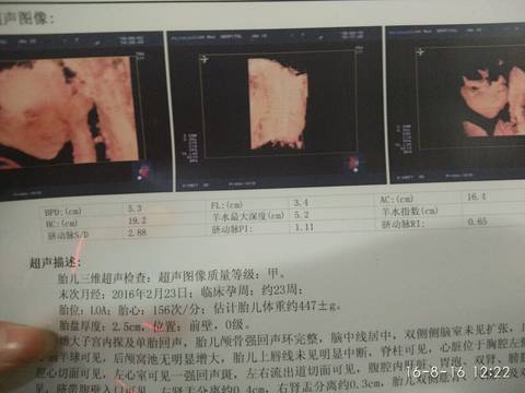 journal_insert_pic_587058157