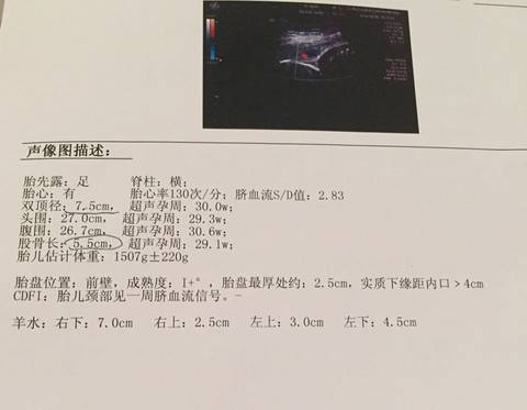 journal_insert_pic_587076153