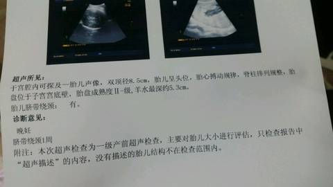 journal_insert_pic_587281783