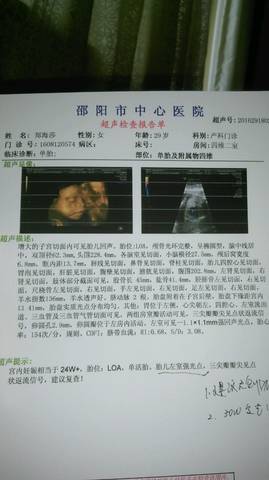 journal_insert_pic_588345614