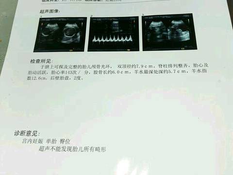 journal_insert_pic_592453927