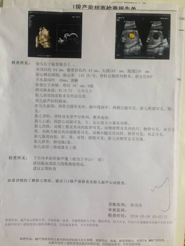 journal_insert_pic_593806439