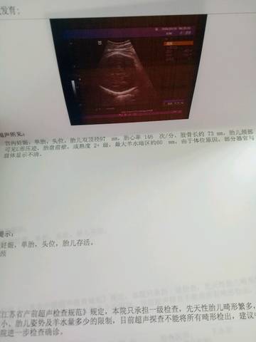 journal_insert_pic_594877257