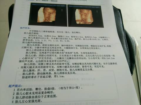 journal_insert_pic_596894136