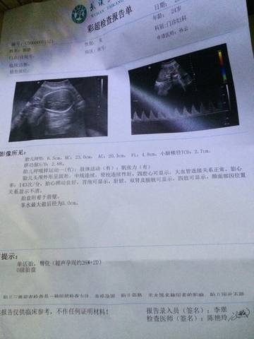 journal_insert_pic_598413289