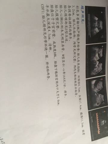 journal_insert_pic_598002948