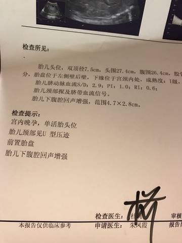 journal_insert_pic_599767978