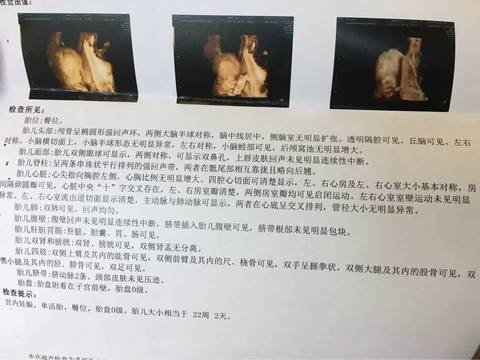 journal_insert_pic_602912714