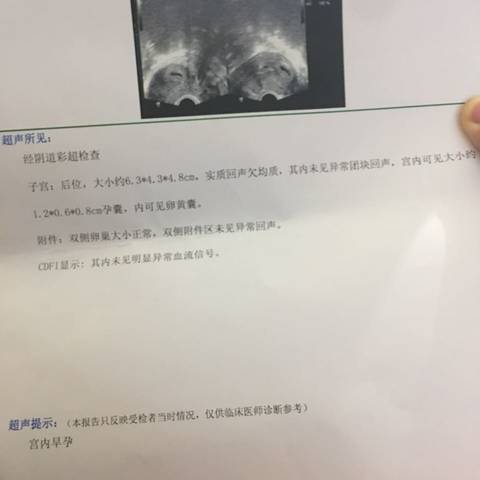 journal_insert_pic_608781380