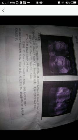 journal_insert_pic_611031129
