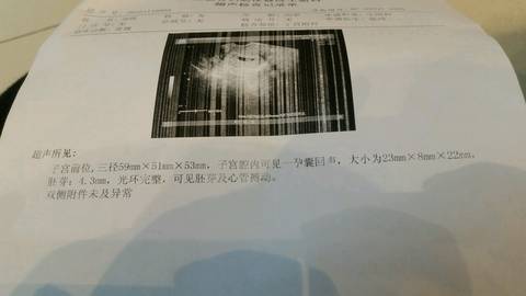journal_insert_pic_612145519