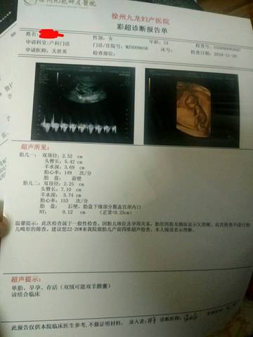 journal_insert_pic_612190337