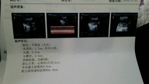 journal_insert_pic_613350778