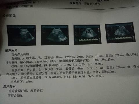 journal_insert_pic_615674190
