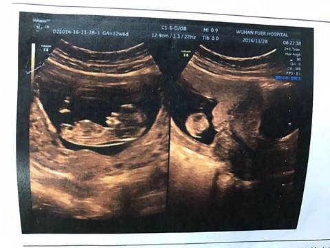 journal_insert_pic_616386246