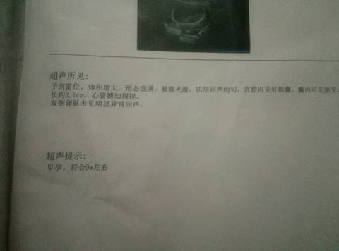 journal_insert_pic_620546089