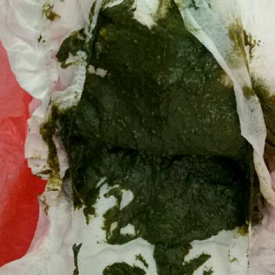 宝宝拉青黑粑粑 粘稠状 是怎麼回事啊