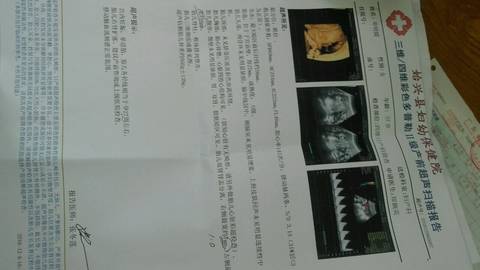 journal_insert_pic_621123287