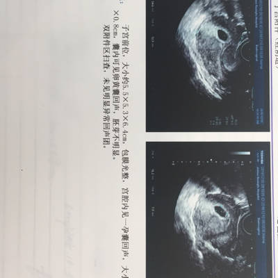 怀男孩40天的孕囊图片图片