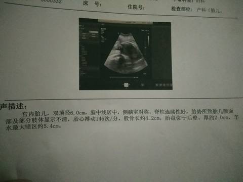 journal_insert_pic_624422407