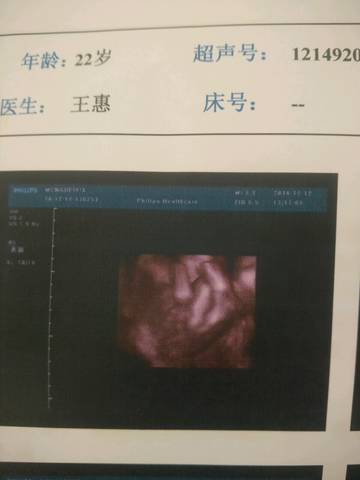 journal_insert_pic_625925406