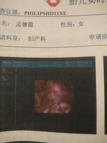 journal_insert_pic_625925392