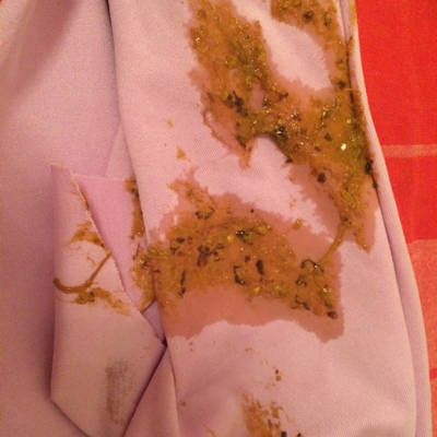 宝宝拉这样的大便 这是怎麼了