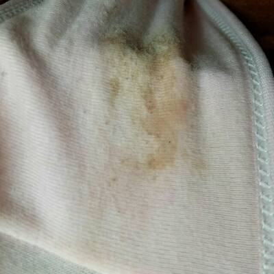 孕三十九天了,谁能告诉我是不是褐色分泌物?