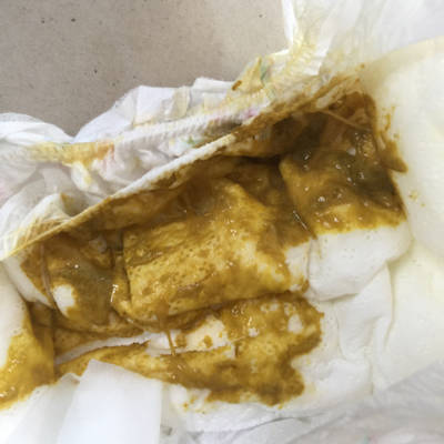 七个半月婴儿一天四,五次大便正常吗