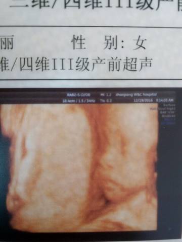 journal_insert_pic_628915853