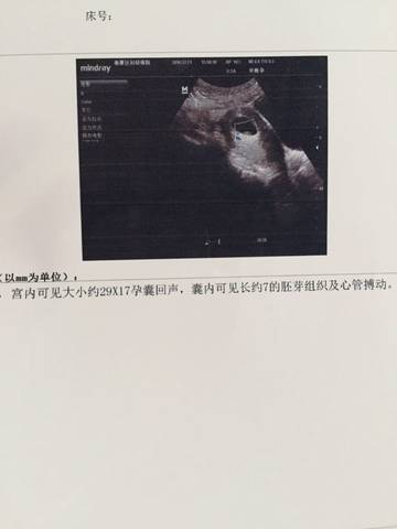 journal_insert_pic_630396846