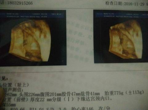 journal_insert_pic_631239154