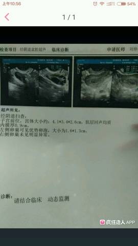 journal_insert_pic_631159801