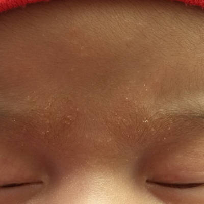 问答 婴儿期0-1岁 育儿问题搜这裏 取消 最佳回答          胎格机,没