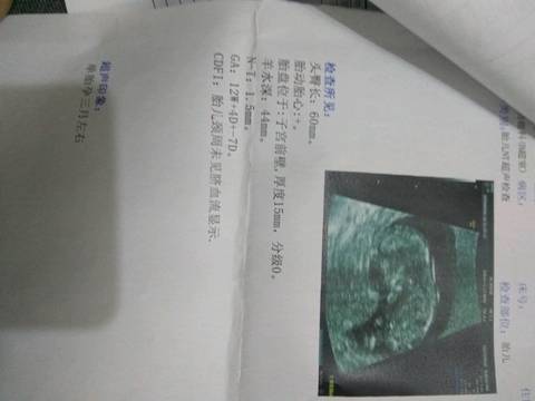 journal_insert_pic_631825769