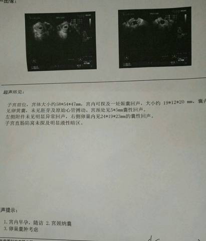 journal_insert_pic_632283960
