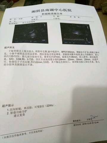 journal_insert_pic_632977749