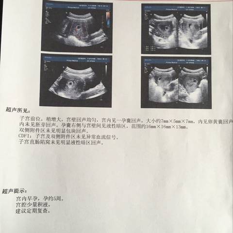 journal_insert_pic_633070592