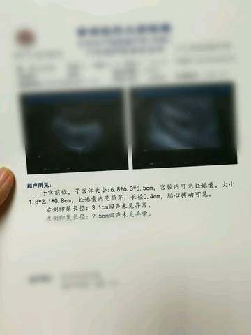 journal_insert_pic_635708372