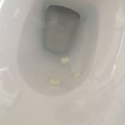 今天上厕所时阴道流出一些乳白色黏稠分泌物 正常吗?有点味道