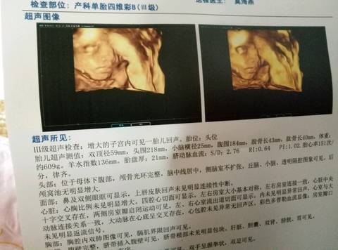 journal_insert_pic_638750104