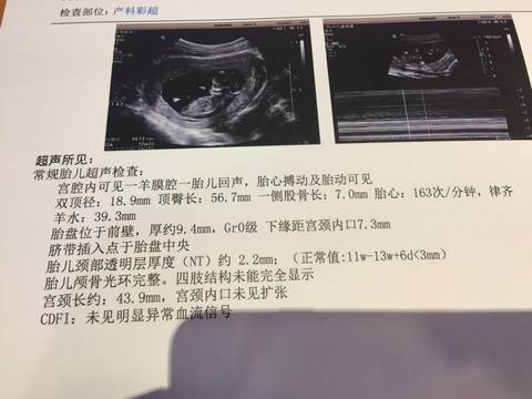 journal_insert_pic_638762022