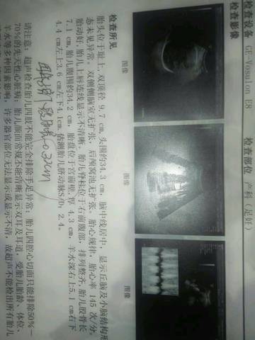 journal_insert_pic_640001287
