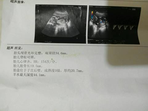 journal_insert_pic_639926867