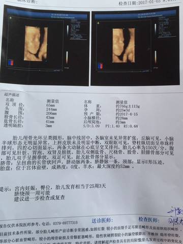 journal_insert_pic_640810123