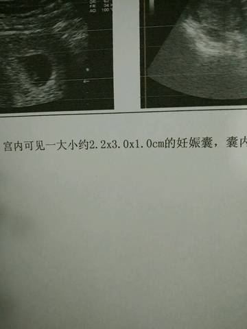 journal_insert_pic_641158990