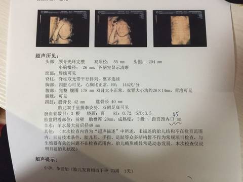 journal_insert_pic_641441903