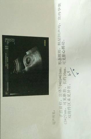 journal_insert_pic_641026082